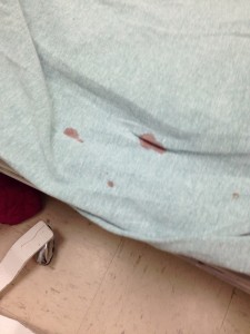 Bloody Sheet at Hutcheson